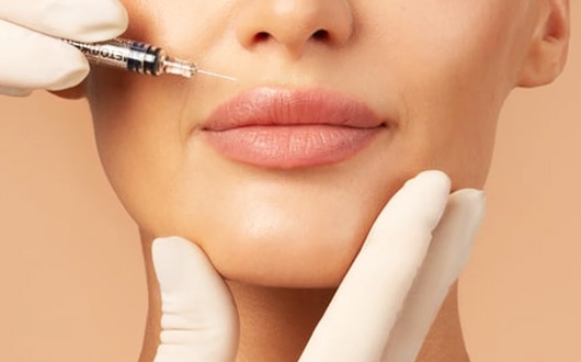 Dudak Üstü Botoksu (Sigara Çizgileri)